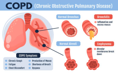 Diagnosed with COPD?
