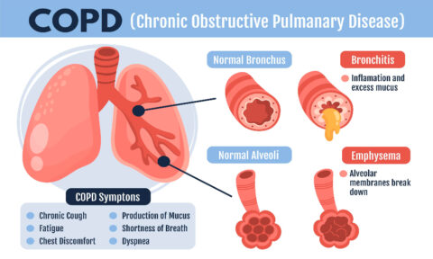 Diagnosed with COPD? - The health journey nurse